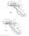 Fig. 04 - SYSTEMS AND METHODS FOR TREATING DYSFUNCTIONS IN THE INTESTINES AND RECTUM THAT ADAPT TO THE ANATOMIC FORM AND STRUCTURE OF DIFFERENT INDIVIDUALS