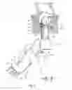 Fig. 09 - SYSTEMS AND METHODS FOR TREATING DYSFUNCTIONS IN THE INTESTINES AND RECTUM THAT ADAPT TO THE ANATOMIC FORM AND STRUCTURE OF DIFFERENT INDIVIDUALS
