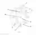 Fig. 05 - Method to remove a tumor using a percutaneous surgical instrument