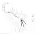 Fig. 07 - Congestive obstruction pulmonary disease (COPD)