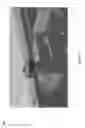 Fig. 08 - Devices and systems for MRI-guided procedures