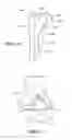 Fig. 24 - Patient Selectable Joint Arthroplasty Devices and Surgical Tools