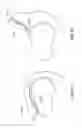 Fig. 54 - Patient Selectable Joint Arthroplasty Devices and Surgical Tools