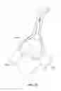 Fig. 56 - Patient Selectable Joint Arthroplasty Devices and Surgical Tools