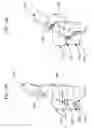 Fig. 16 - Intra-operative system for identifying and tracking surgical sharp objects, instruments, and sponges