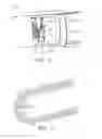 Fig. 06 - Pen-like dispenser for a dental material