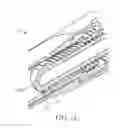 Fig. 07 - Pen-like dispenser for a dental material