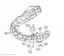 Fig. 01 - System and method for detecting deviations during the course of an orthodontic treatment to gradually reposition teeth