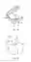 Fig. 04 - System and method for detecting deviations during the course of an orthodontic treatment to gradually reposition teeth