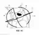 Fig. 12 - System and method for detecting deviations during the course of an orthodontic treatment to gradually reposition teeth