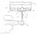 Fig. 01 - Dental prosthesis