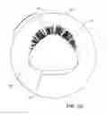 Fig. 03 - ELECTRIC TOOTHBRUSH FOR PROPER PERIODONTIUM PROPHYLAXIS