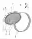 Fig. 02 - Hernia patch