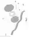 Fig. 05 - Hernia patch