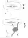Fig. 06 - Hernia patch