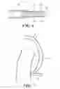 Fig. 05 - Stent to be placed in bile duct