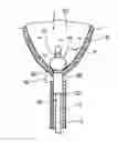 Fig. 01 - Coupling a body conduit to tissue