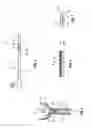 Fig. 05 - Coupling a body conduit to tissue
