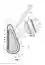 Fig. 02 - Inflatable prostheses and methods of making same