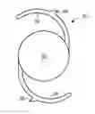Fig. 01 - INTRAOCULAR LENS