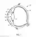 Fig. 02 - INTRAOCULAR LENS