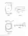 Fig. 03 - INTRAOCULAR LENS