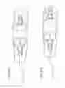 Fig. 12 - Methods and apparatuses for deploying minimally-invasive heart valves