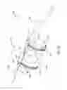 Fig. 20 - Methods and apparatuses for deploying minimally-invasive heart valves