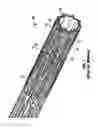 Fig. 02 - Devices and methods for collapsing prosthetic heart valves