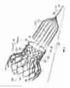 Fig. 06 - Devices and methods for collapsing prosthetic heart valves