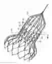 Fig. 15 - Devices and methods for collapsing prosthetic heart valves