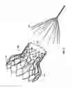Fig. 16 - Devices and methods for collapsing prosthetic heart valves