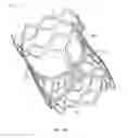 Fig. 03 - Collapsible prosthetic heart valves