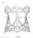 Fig. 05 - Collapsible prosthetic heart valves