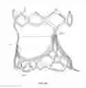 Fig. 06 - Collapsible prosthetic heart valves