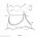 Fig. 07 - Collapsible prosthetic heart valves