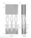Fig. 08 - Collapsible prosthetic heart valves
