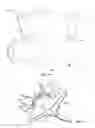 Fig. 13 - Collapsible prosthetic heart valves