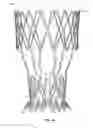 Fig. 30 - Collapsible prosthetic heart valves