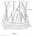 Fig. 42 - Collapsible prosthetic heart valves