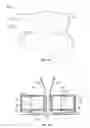 Fig. 43 - Collapsible prosthetic heart valves