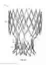 Fig. 48 - Collapsible prosthetic heart valves