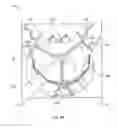 Fig. 52 - Collapsible prosthetic heart valves