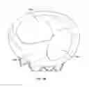 Fig. 53 - Collapsible prosthetic heart valves