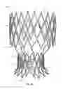 Fig. 57 - Collapsible prosthetic heart valves