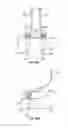 Fig. 61 - Collapsible prosthetic heart valves