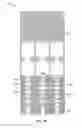 Fig. 62 - Collapsible prosthetic heart valves