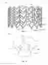 Fig. 63 - Collapsible prosthetic heart valves