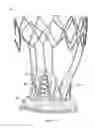 Fig. 64 - Collapsible prosthetic heart valves