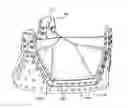 Fig. 01 - Prosthetic heart valve with retention elements